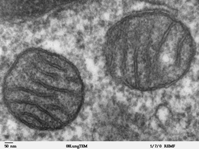 Elektronenmikroskopische Aufnahme zweier Mitochondrien aus Säugetier-Lungengewebe mit sichtbaren Cristae-Folds
